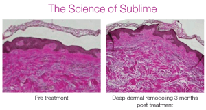 The Science Of Sublime